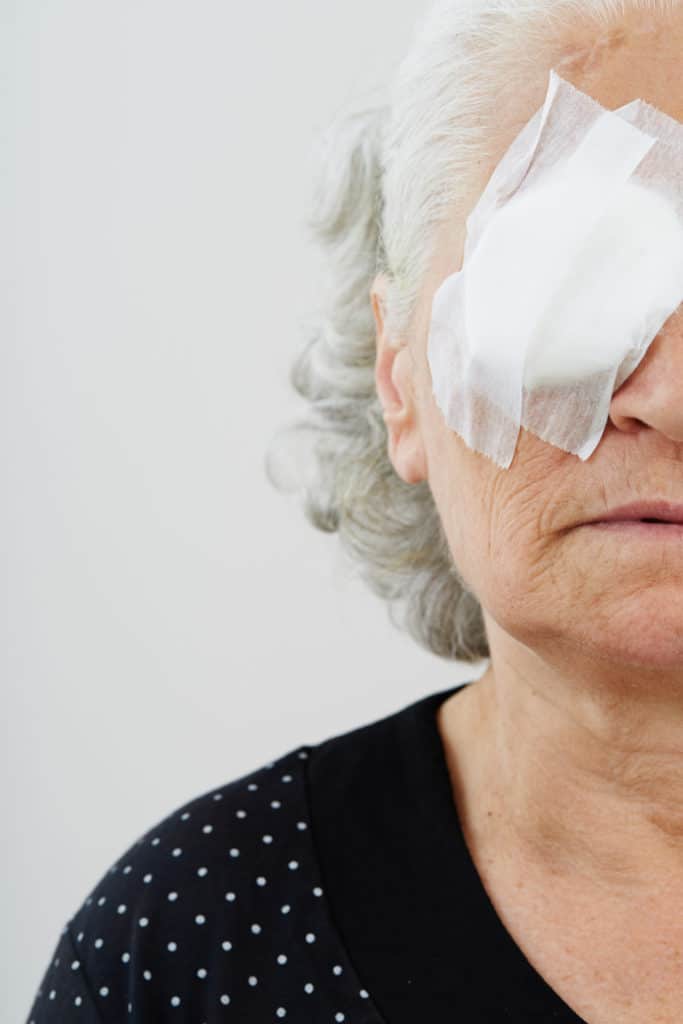 Senior woman with eye patch from cataract surgery