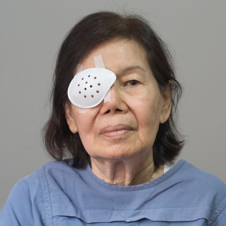 Cataract patient with her eye patched